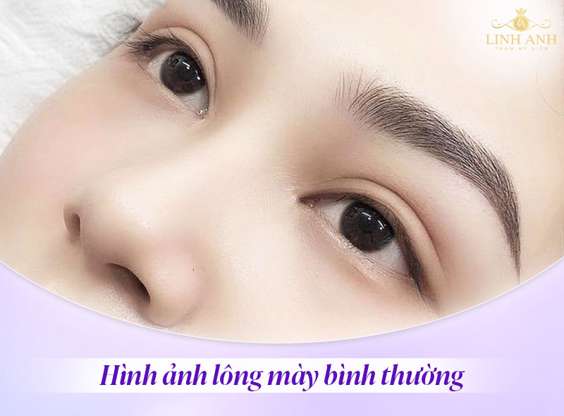lông mày khi mang thai trông như thế nào lông mày khi mang thai trông như thế nào