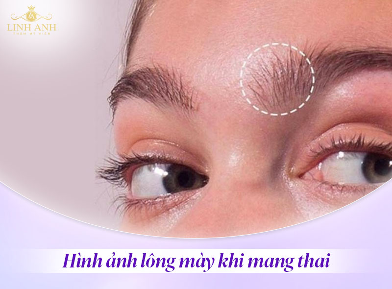 lông mày khi mang thai và lông mày bình thường lông mày khi mang thai và lông mày bình thường