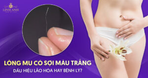 Lông mu có sợi màu trắng
