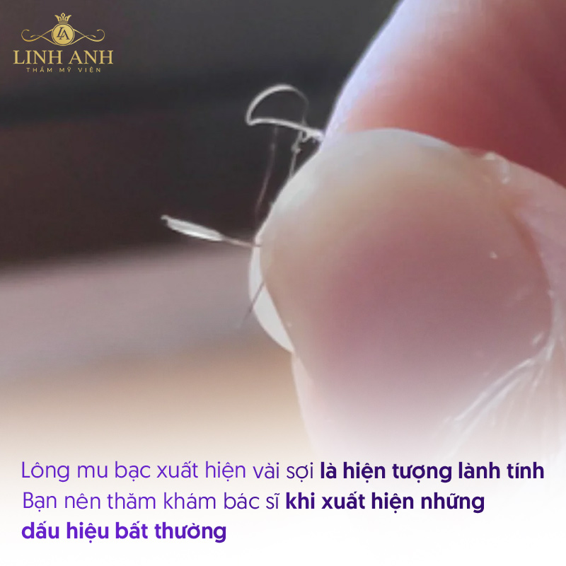 Lông mu có sợi màu trắng có sao không Lông mu có sợi màu trắng có sao không