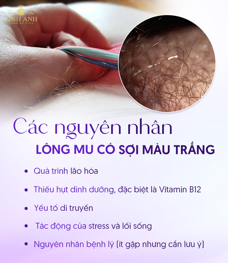 Lông mu có sợi màu trắng do đâu Lông mu có sợi màu trắng do đâu