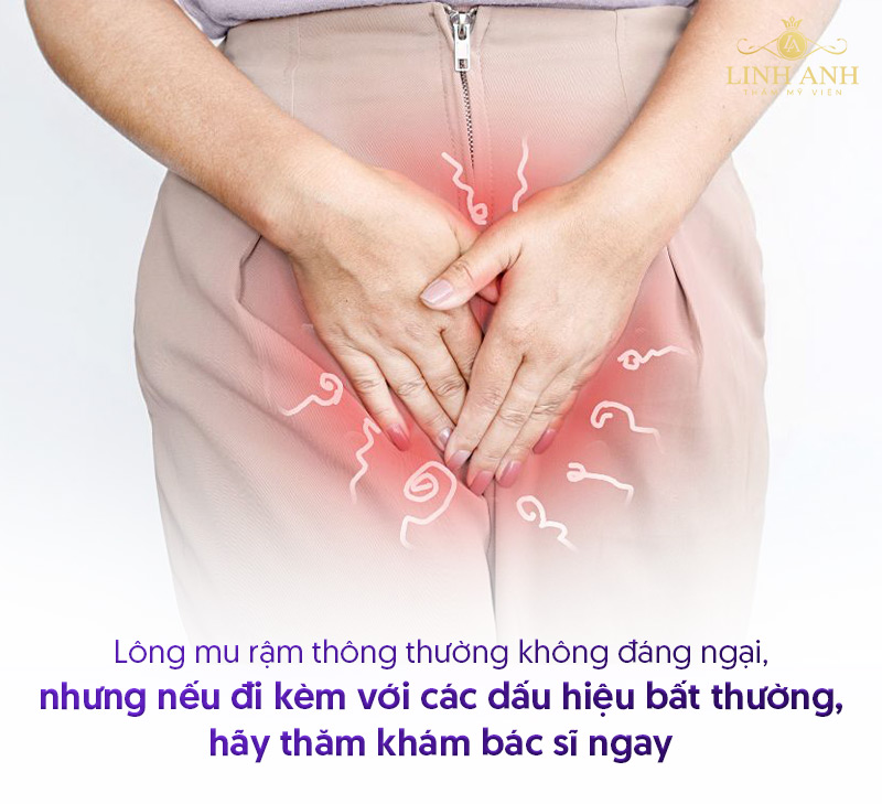 Lông mu rậm có sao không Lông mu rậm có sao không
