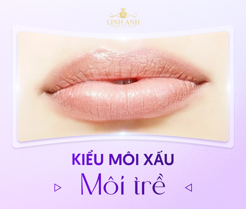 miệng xấu miệng xấu