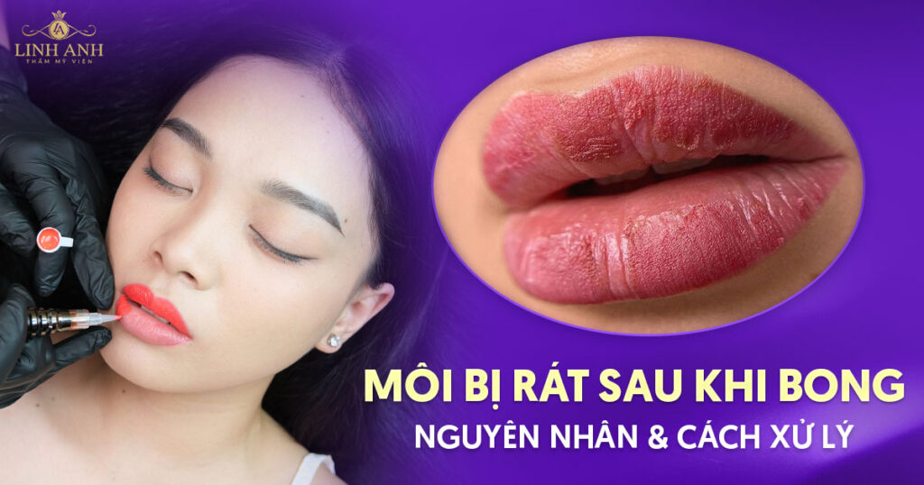 môi bị rát sau khi bong