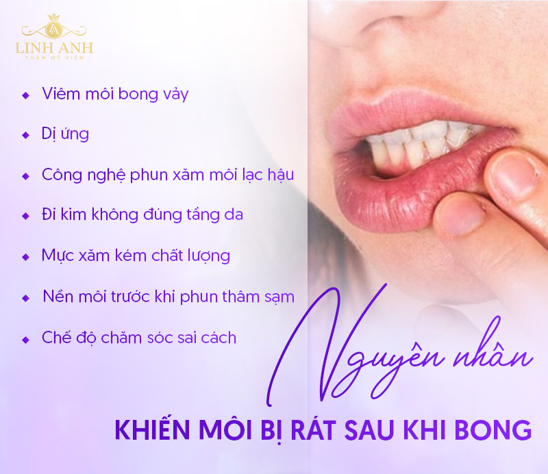 môi bị rát sau khi bong do đâu môi bị rát sau khi bong do đâu