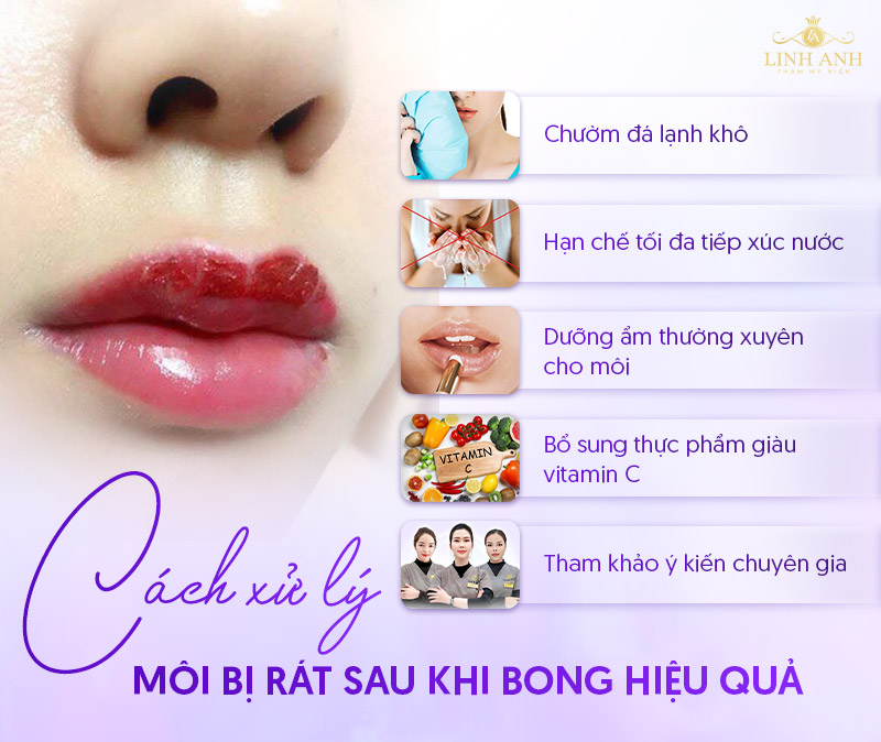 môi bị rát sau khi bong phải làm sao môi bị rát sau khi bong phải làm sao