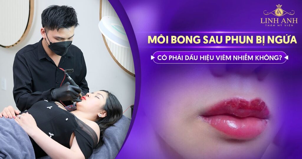 môi bong sau phun bị ngứa