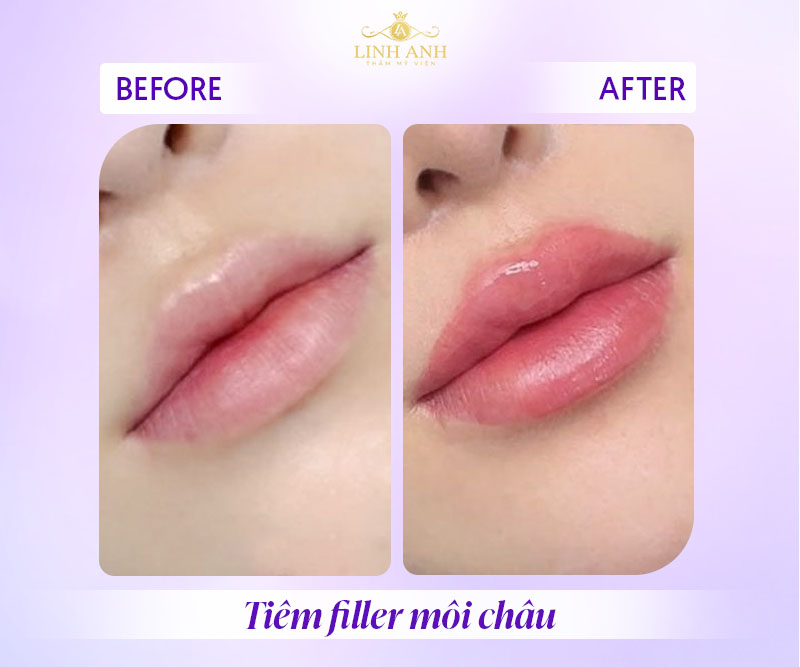 môi châu có hình dáng như thế nào môi châu có hình dáng như thế nào