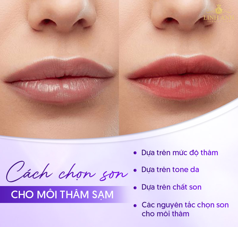 Môi dày thâm nên dùng son màu gì
