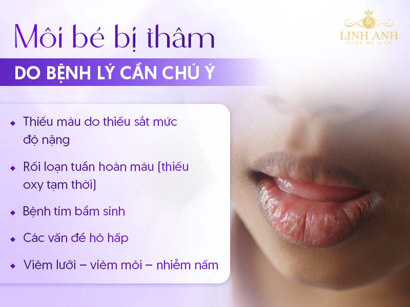 môi em bé bị thâm môi em bé bị thâm