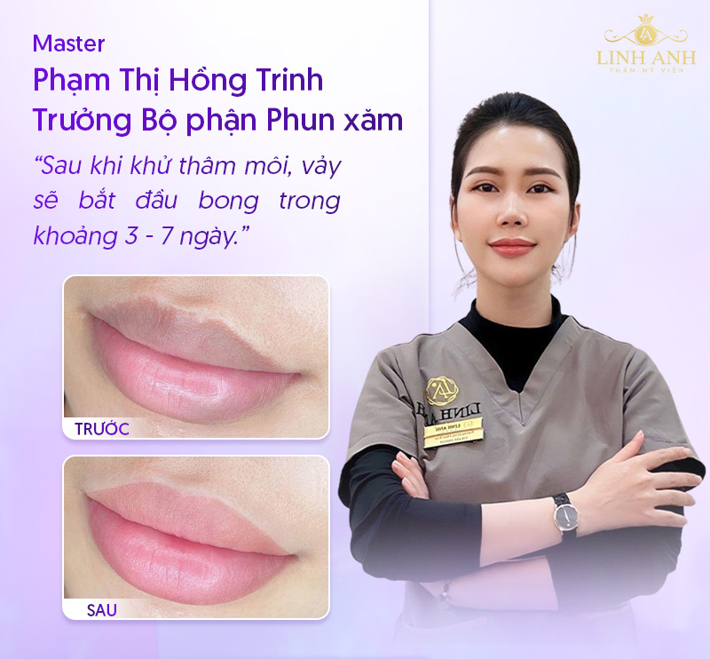 môi khử thâm bao lâu thì bong môi khử thâm bao lâu thì bong