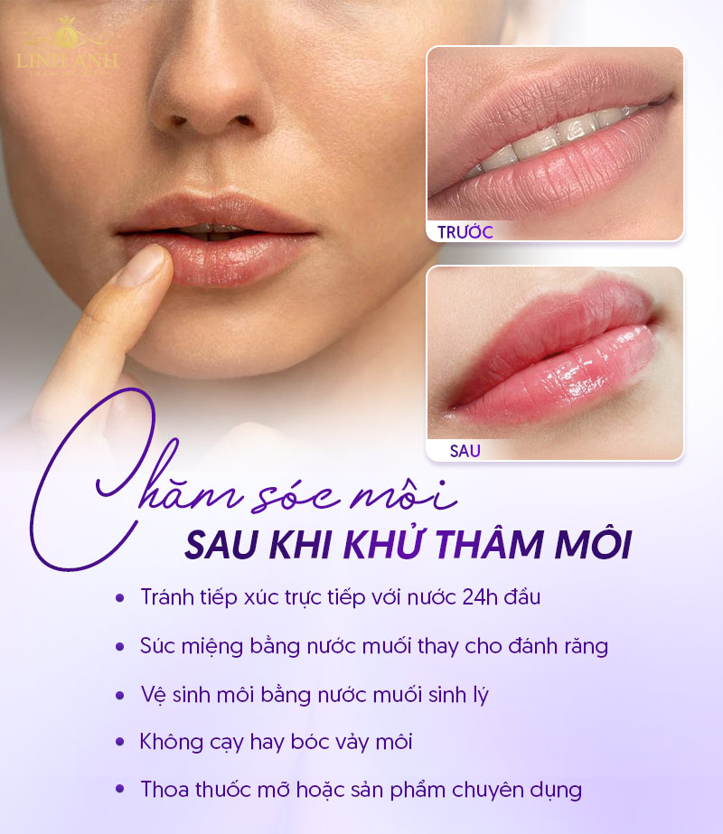 môi khử thâm mấy ngày thì bong môi khử thâm mấy ngày thì bong