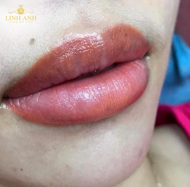 môi sau phun xăm như thế nào môi sau phun xăm như thế nào