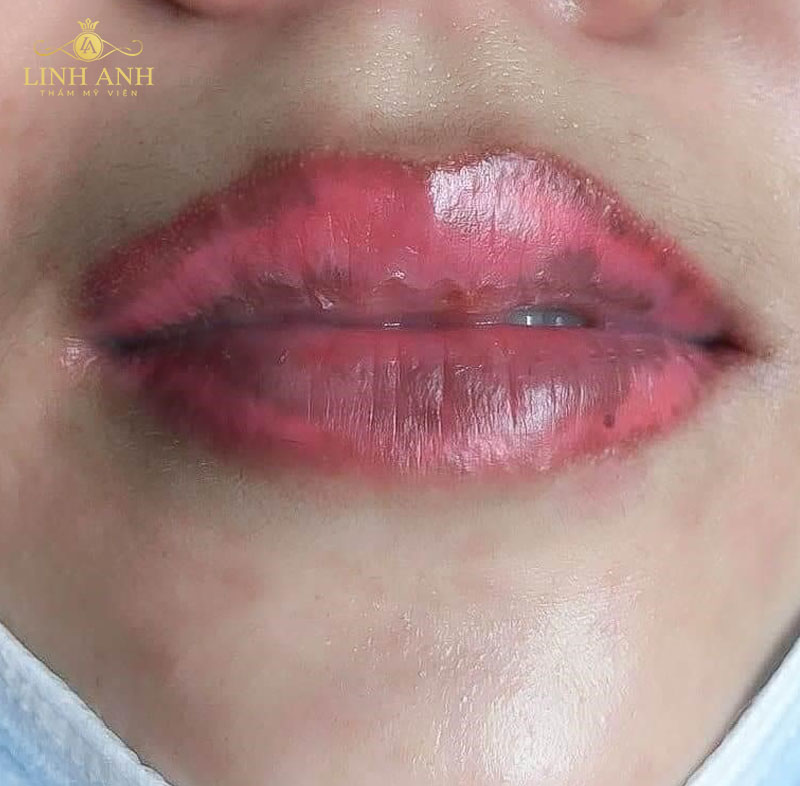 môi sau xăm như thế nào môi sau xăm như thế nào