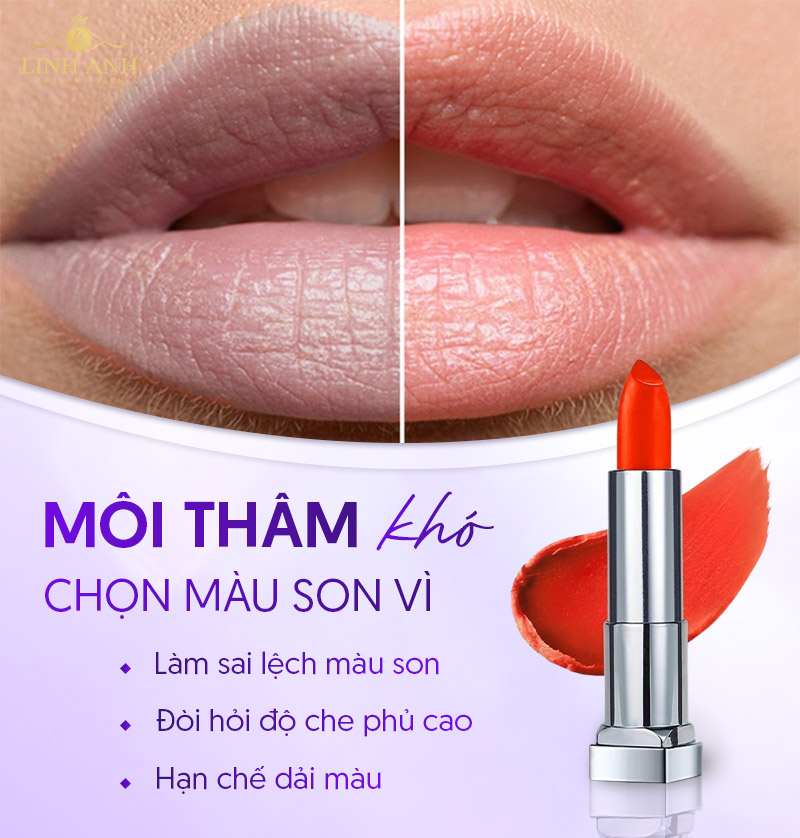 Môi thâm nên dùng son gì