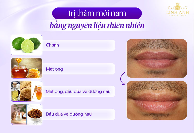 môi thâm ở nam giới vì sao môi thâm ở nam giới vì sao