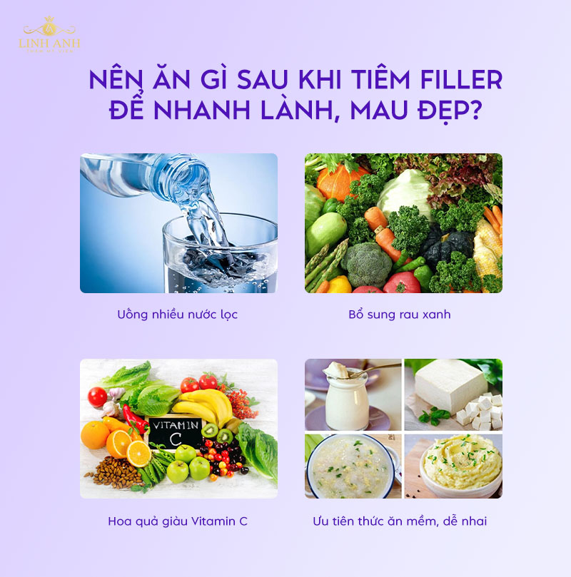 Mới tiêm filler nên kiêng gì