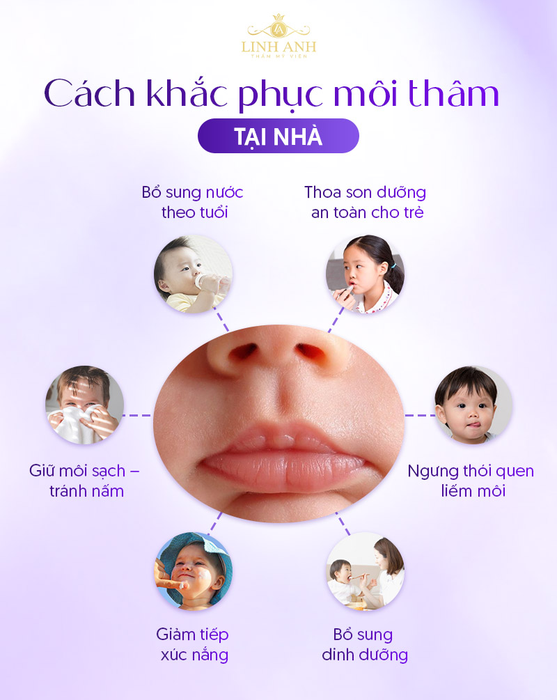 môi trẻ em bị xỉn màu do đâu môi trẻ em bị xỉn màu do đâu