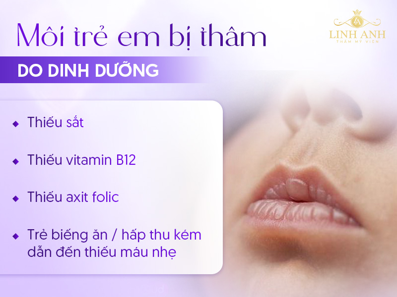 môi trẻ sơ sinh bị thâm môi trẻ sơ sinh bị thâm
