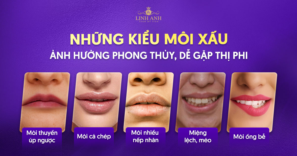Top 9 dáng môi xấu ảnh hưởng phong thủy, dễ gặp thị phi