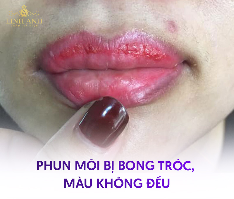 những hình ảnh phun môi bị hỏng