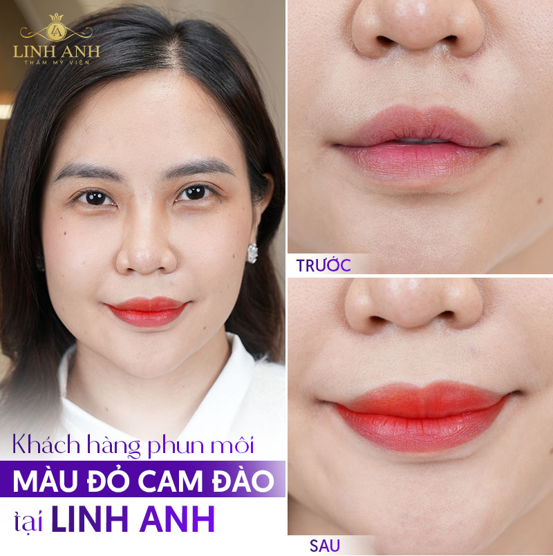 phun môi collagen màu đỏ cam đào phun môi collagen màu đỏ cam đào