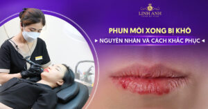 phun môi xong bị khô