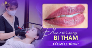 phun môi xong bị thâm có sao không