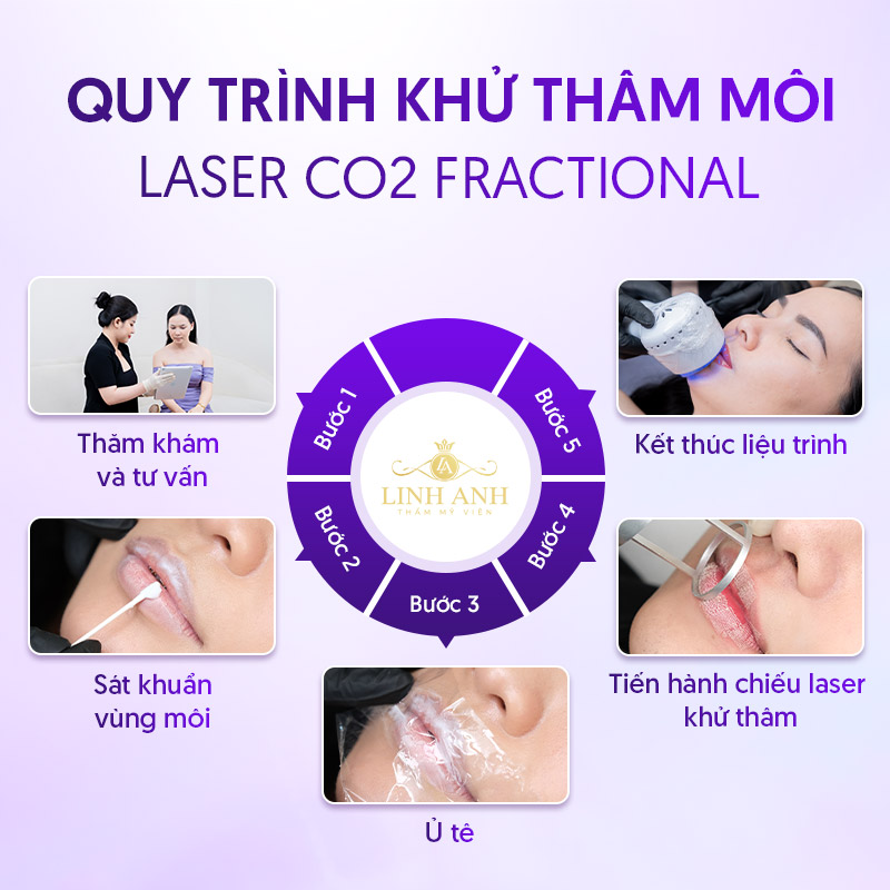 Quy trình Khử thâm môi bằng Laser CO2 Fractional