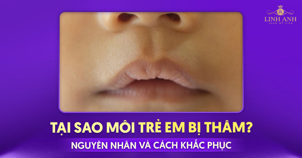 tại sao môi trẻ em bị thâm