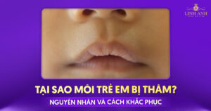 tại sao môi trẻ em bị thâm