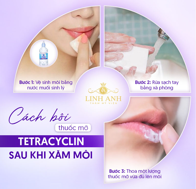 thuốc mỡ tra mắt Tetracyclin bôi môi được không