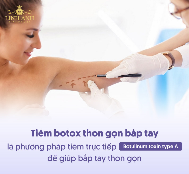 Tiêm botox thon gọn bắp tay Tiêm botox thon gọn bắp tay