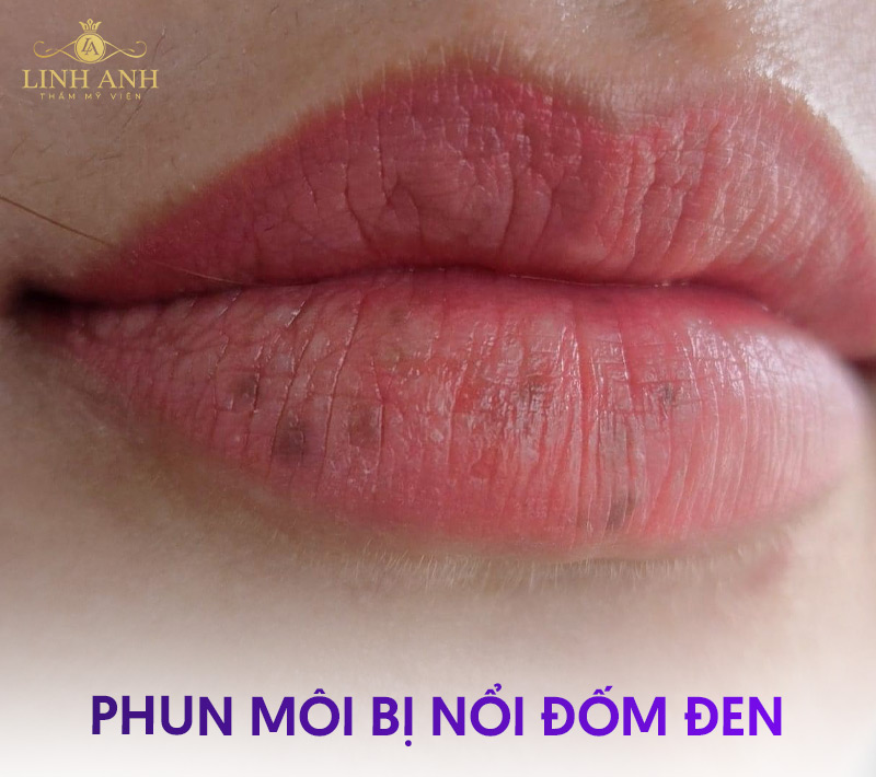 tổng hợp hình ảnh xăm môi hỏng