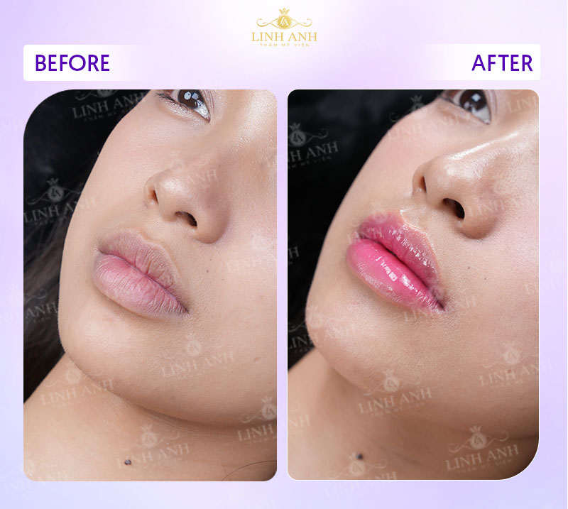 tổng hợp hình ảnh xăm môi tổng hợp hình ảnh xăm môi