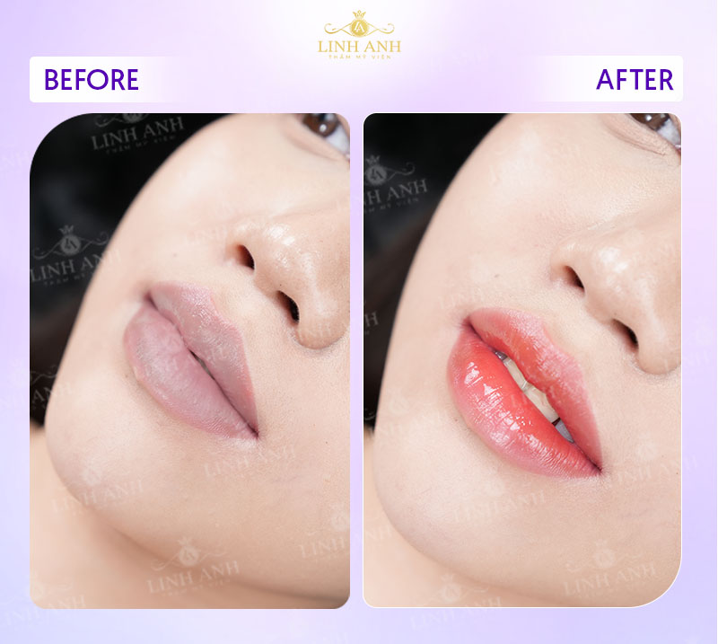 top hình phun môi đẹp top hình phun môi đẹp