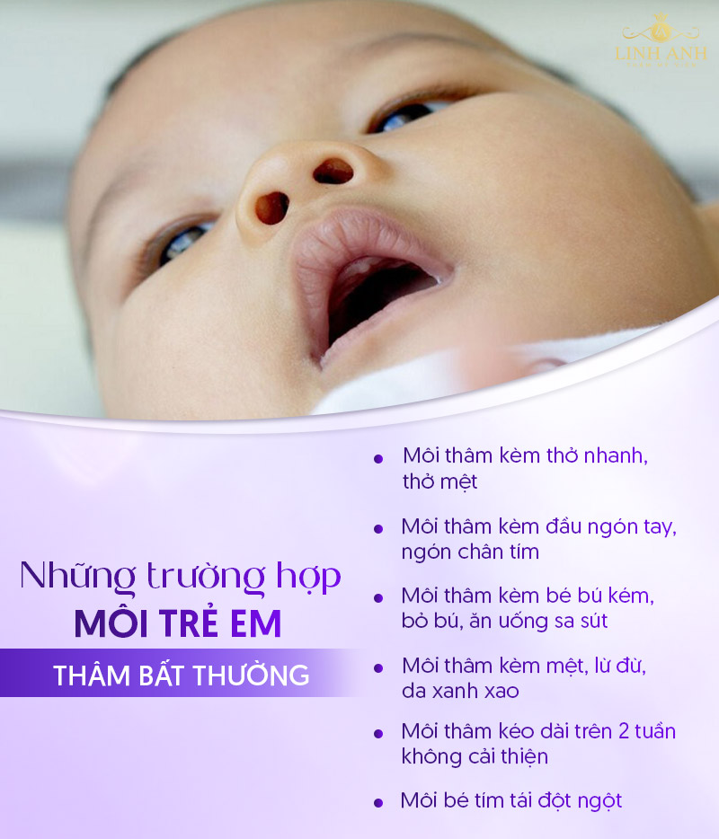 trẻ sơ sinh môi thâm trẻ sơ sinh môi thâm