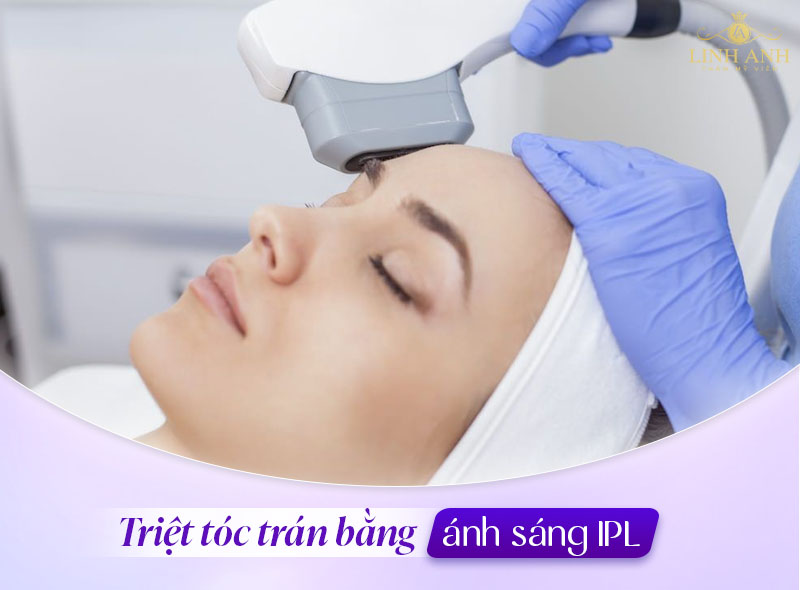 Triệt chân tóc ánh sáng IPL Triệt chân tóc