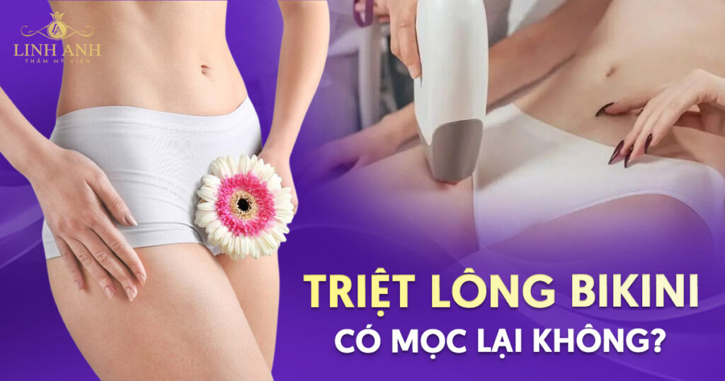 Triệt lông bikini có mọc lại không