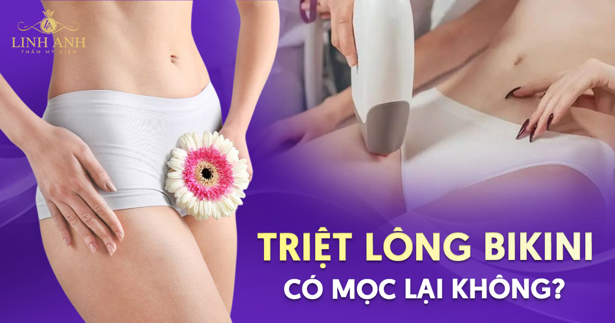 Triệt lông bikini có mọc lại không? Yếu tố ảnh hưởng