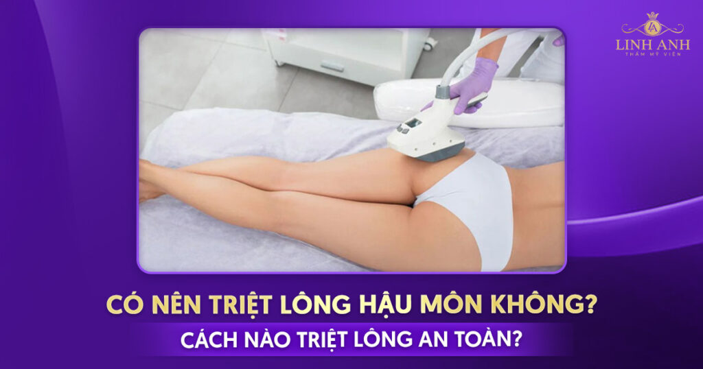 Triệt lông hậu môn