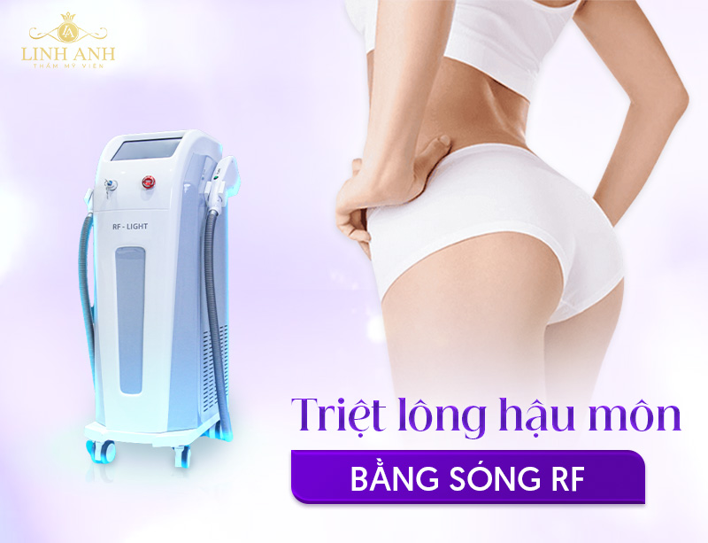 Triệt lông hậu môn nam RF