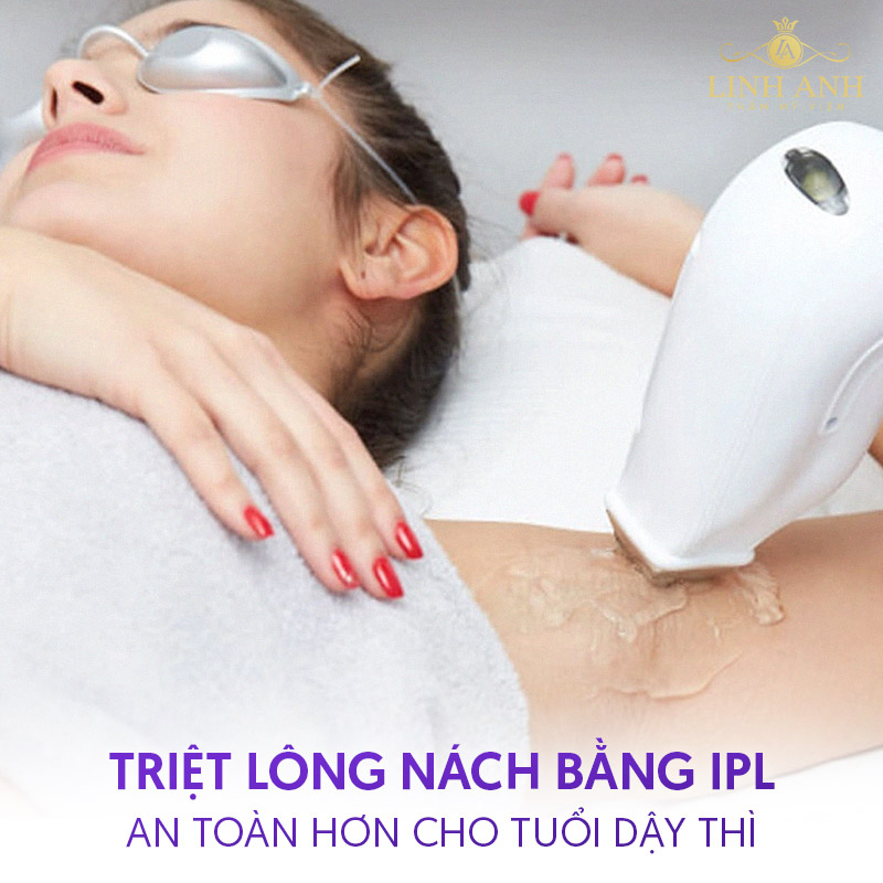 Triệt lông nách ở tuổi dậy thì IPL