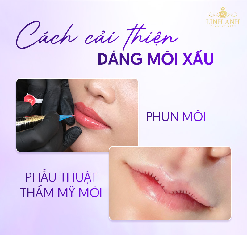 tướng môi xấu ở nam tướng môi xấu ở nam