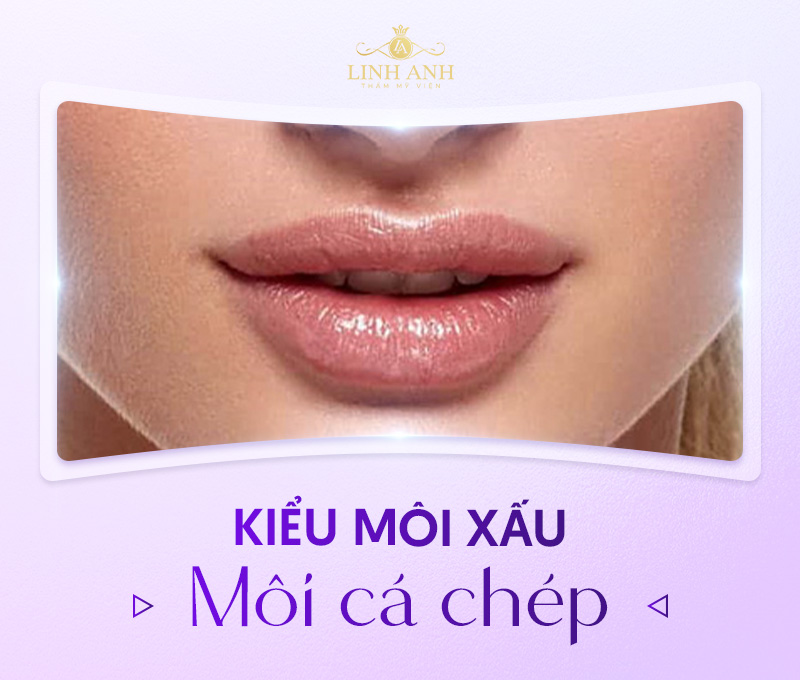 tướng môi xấu tướng môi xấu