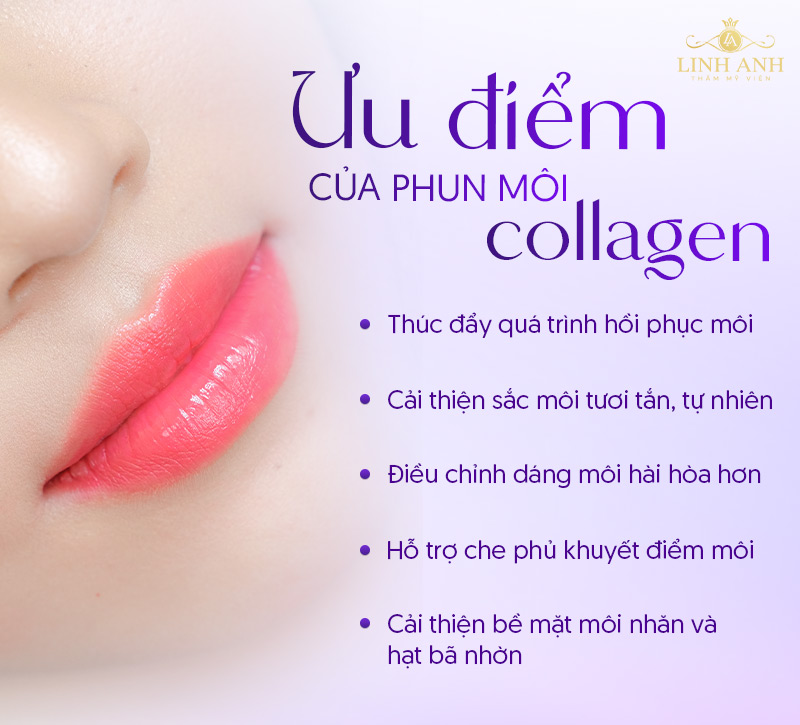 ưu nhược điểm khi phun môi collagen ưu nhược điểm khi phun môi collagen