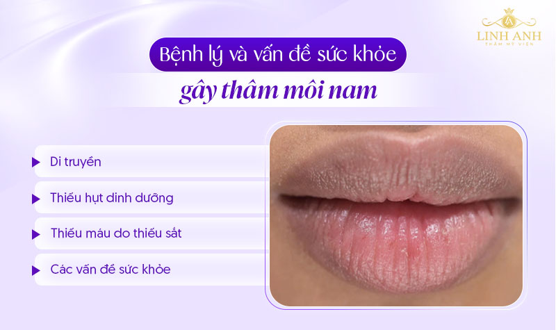 vì sao môi thâm ở nam giới vì sao môi thâm ở nam giới
