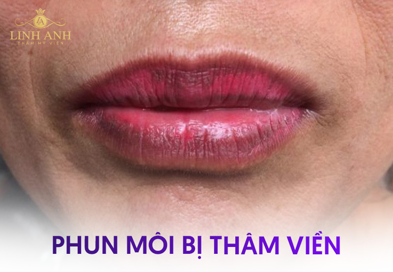 xăm môi bị hỏng sẽ như thế nào