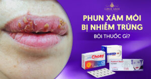 xăm môi bị nhiễm trùng bôi thuốc gì