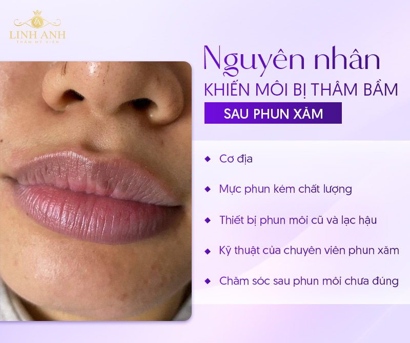 xăm môi bị thâm phải làm sao xăm môi bị thâm phải làm sao